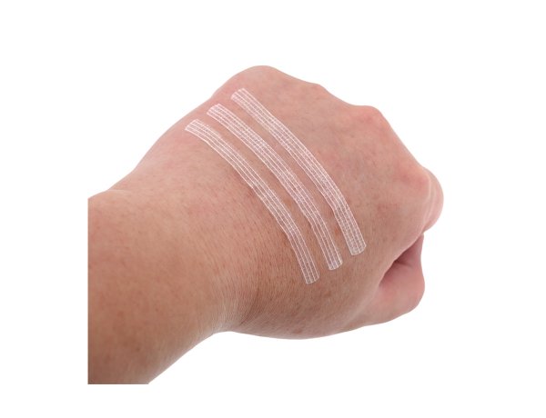 Wound Skin Closuer